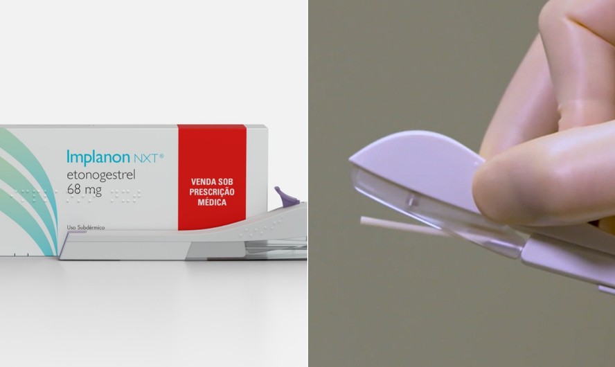 Fachada do Ministério da Saúde em Brasília, sede da decisão sobre implante contraceptivo para adolescentes