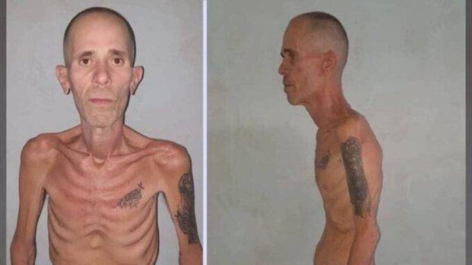Preso político cubano libertado em condição física extrema após período sob custódia do regime