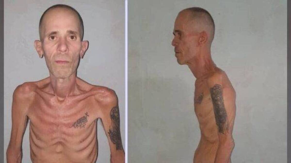 Preso político cubano libertado em condição física extrema após período sob custódia do regime